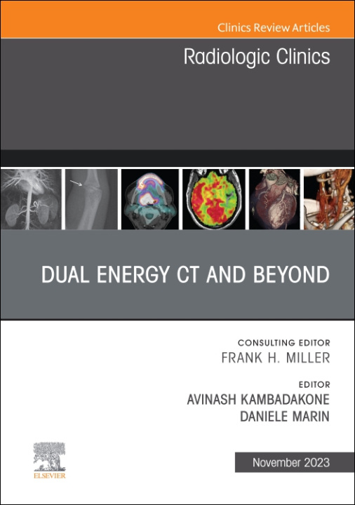 Carte Dual Energy CT and Beyond, An Issue of Radiologic Clinics of North America Avinash Kambadakone