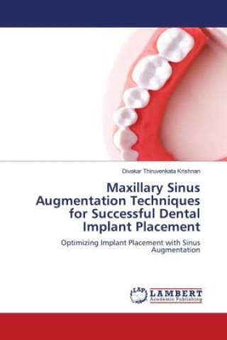 Könyv Maxillary Sinus Augmentation Techniques for Successful Dental Implant Placement 