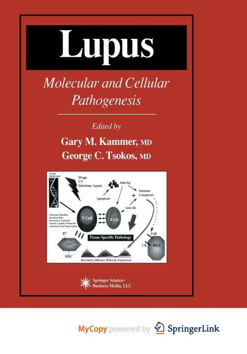 Kniha Lupus Gary M. Kammer