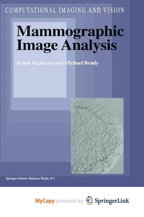 Knjiga Mammographic Image Analysis Highnam R. Highnam