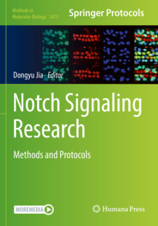 Carte Notch Signaling Research Dongyu Jia