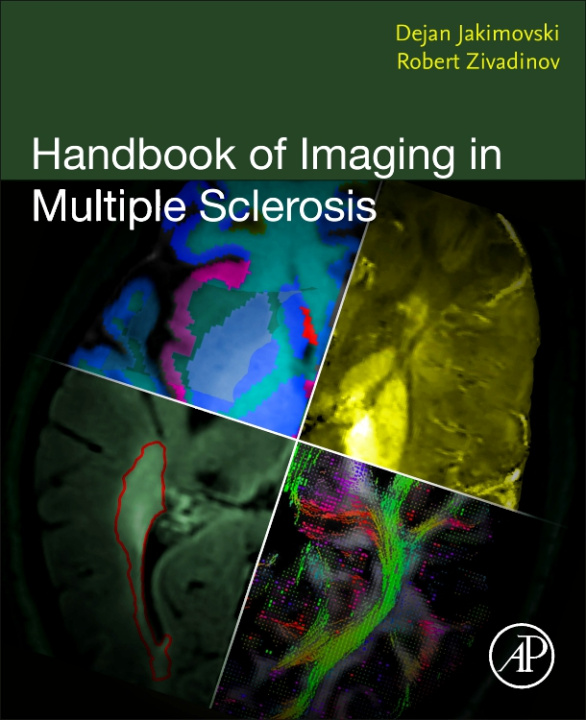 Könyv Handbook of Imaging in Multiple Sclerosis Dejan Jakimovski