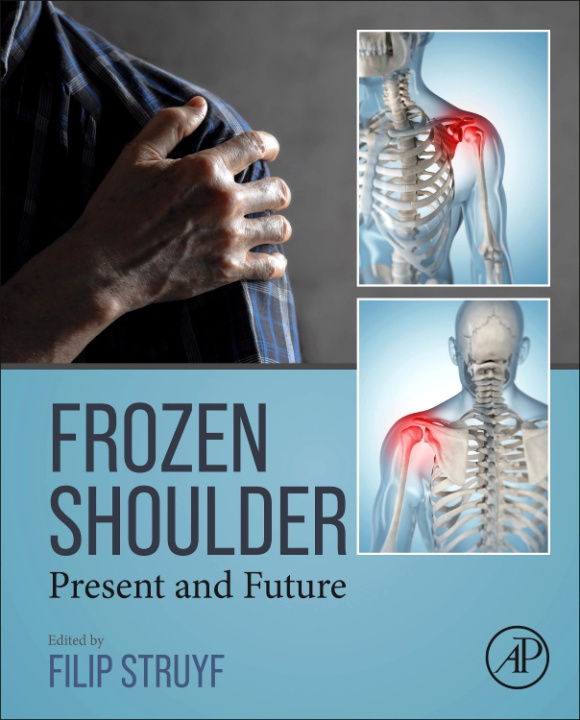 Knjiga Frozen Shoulder Filip Struyf