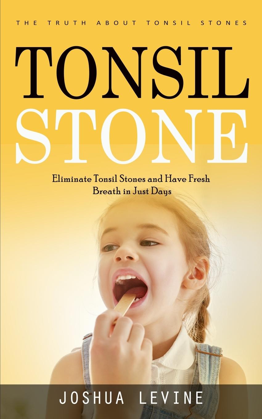 Kniha Tonsil Stones 