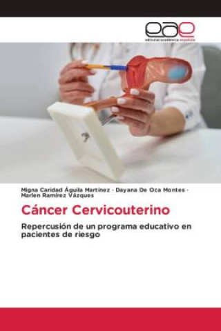 Livro Cáncer Cervicouterino Dayana de Oca Montes