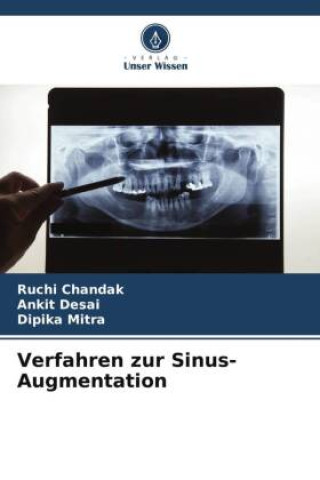 Kniha Verfahren zur Sinus-Augmentation Ankit Desai
