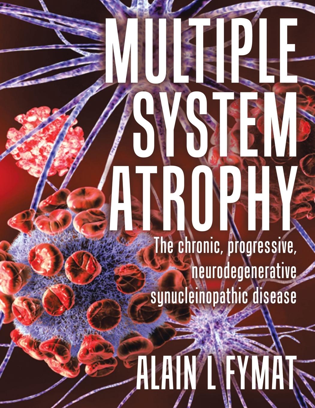 Knjiga Multiple System Atrophy Alain L Fymat