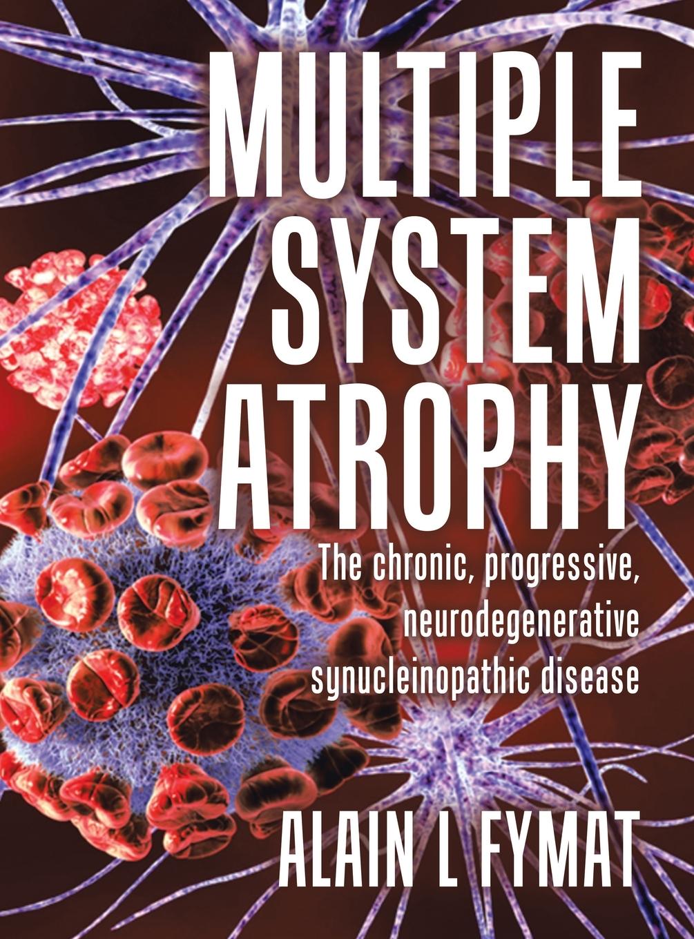 Knjiga Multiple System Atrophy Alain L Fymat