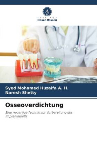 Knjiga Osseoverdichtung Naresh Shetty