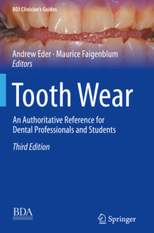 Kniha Tooth Wear Andrew Eder