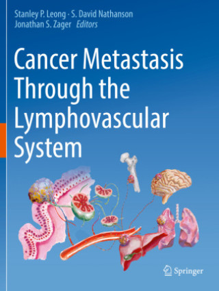Könyv Cancer Metastasis Through the Lymphovascular System Stanley P. Leong