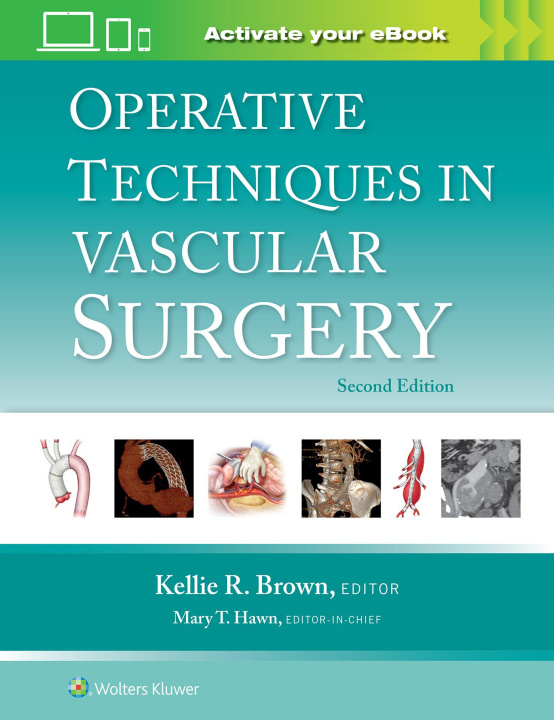 Kniha Operative Techniques in Vascular Surgery 