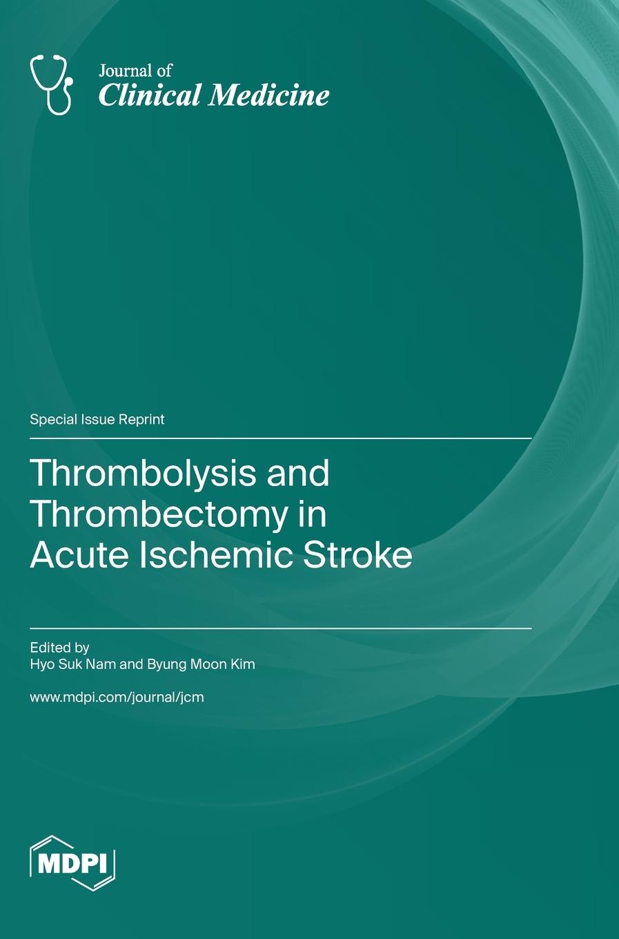 Kniha Thrombolysis and Thrombectomy in Acute Ischemic Stroke 