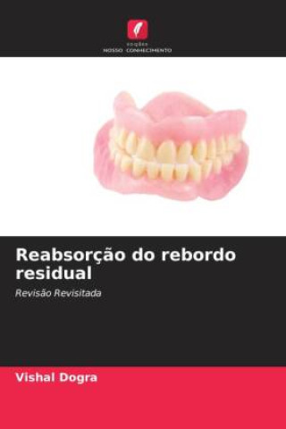 Knjiga Reabsorção do rebordo residual Vishal Dogra