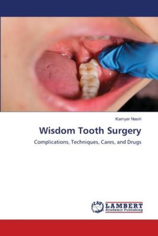 Knjiga Wisdom Tooth Surgery Kamyar Nasiri