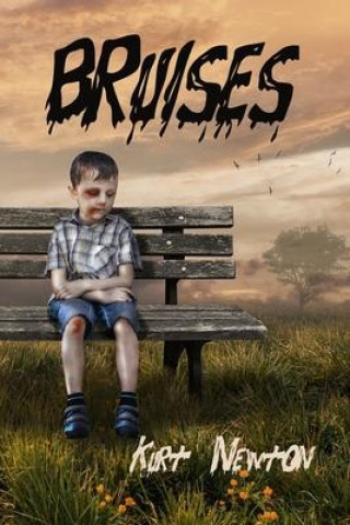 Book Bruises Kurt Newton