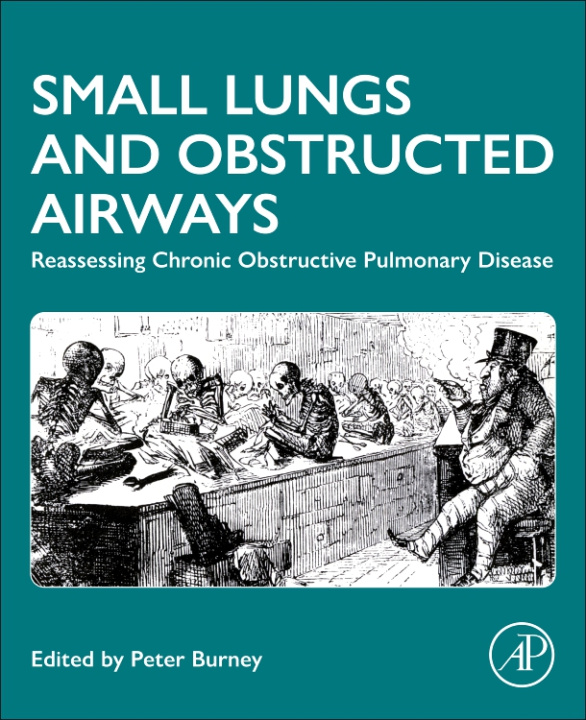 Книга Lung Size, Function and Health Peter Burney