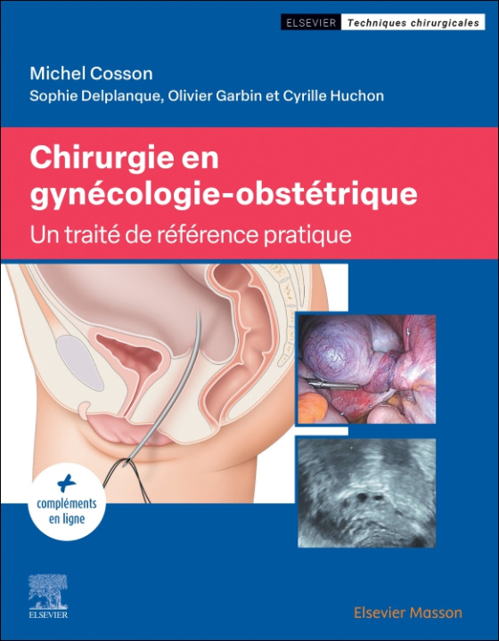 Kniha Chirurgie en gynécologie-obstétrique Michel Cosson