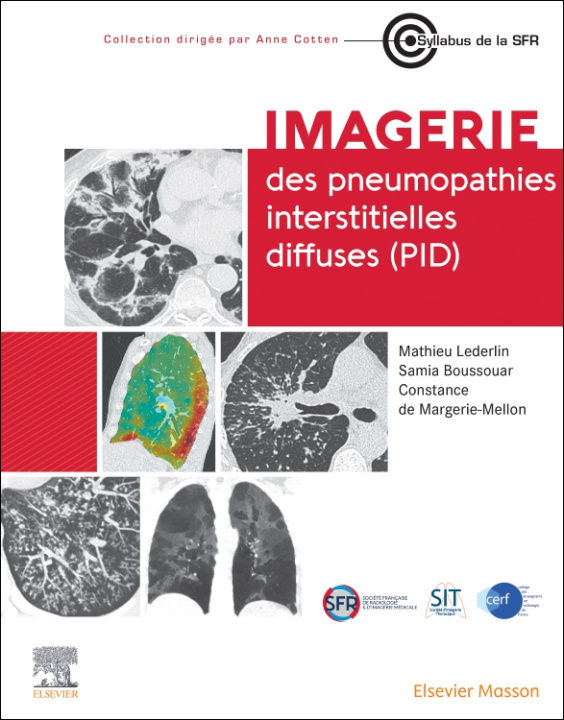 Knjiga Imagerie des pneumopathies interstitielles diffuses (PID) Professeur Mathieu Lederlin