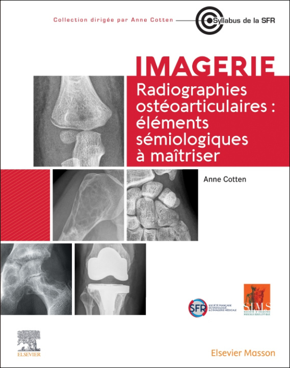 Kniha Radiographies ostéoarticulaires : éléments sémiologiques à maitriser Anne Cotten