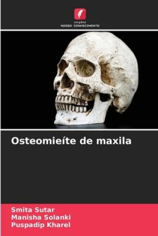 Buch Osteomieíte de maxila Manisha Solanki