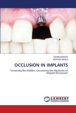 Knjiga OCCLUSION IN IMPLANTS Deepak Mahla