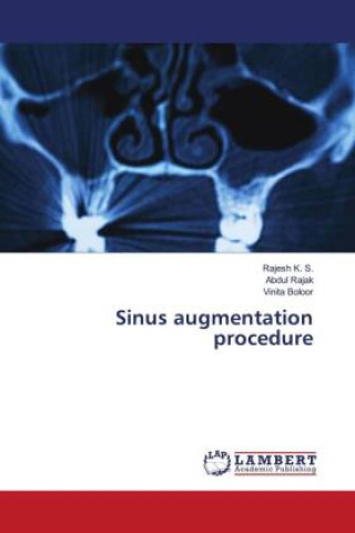 Książka Sinus augmentation procedure Abdul Rajak