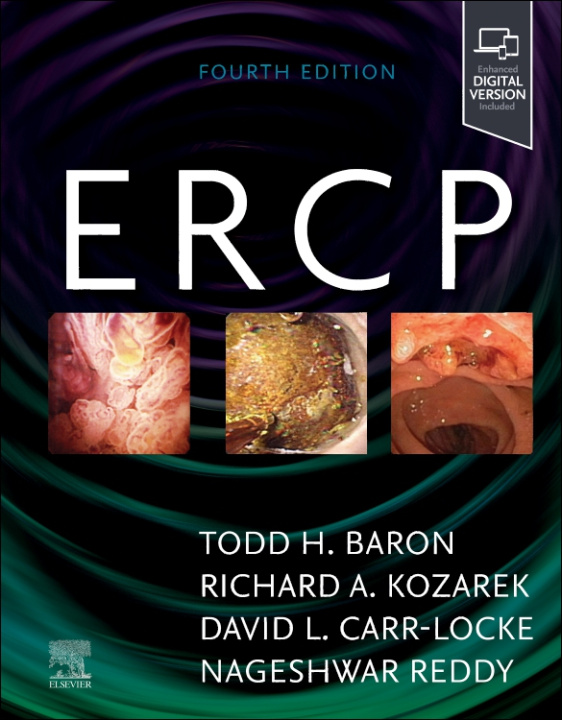 Książka ERCP Todd H. Baron