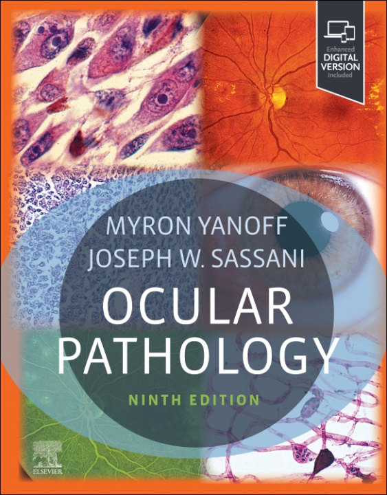 Książka Ocular Pathology Myron Yanoff