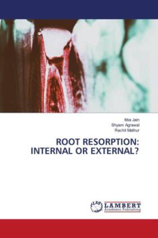 Knjiga ROOT RESORPTION: INTERNAL OR EXTERNAL? Shyam Agrawal