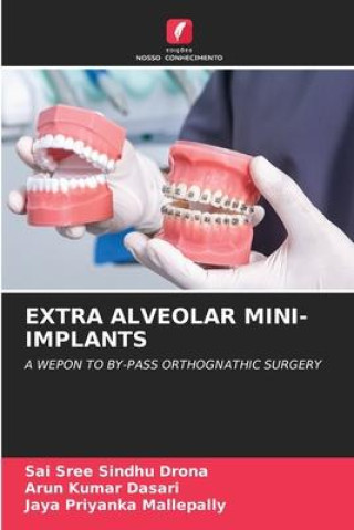 Knjiga EXTRA ALVEOLAR MINI-IMPLANTS Arun Kumar Dasari