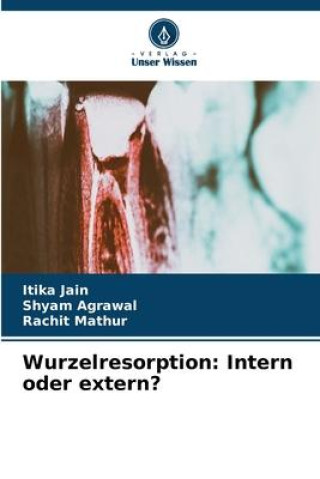 Knjiga Wurzelresorption: Intern oder extern? Shyam Agrawal