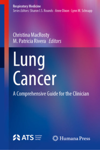 Kniha Lung Cancer Christina MacRosty