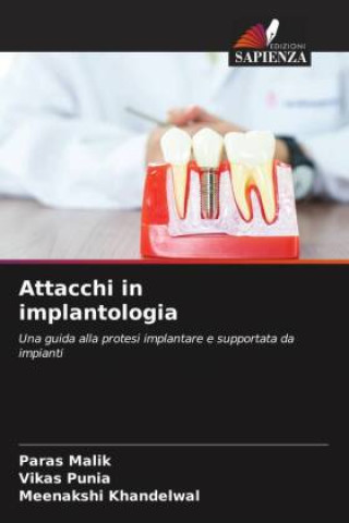 Könyv Attacchi in implantologia Vikas Punia