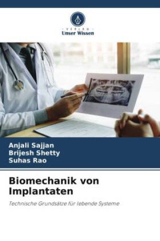 Kniha Biomechanik von Implantaten Brijesh Shetty