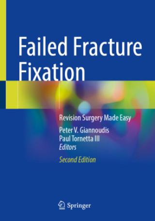 Kniha Failed Fracture Fixation Peter V. Giannoudis