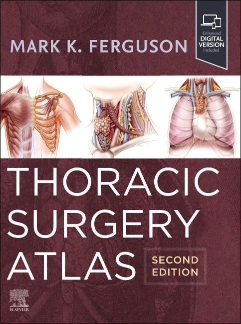 Könyv Thoracic Surgery Atlas Mark K. Ferguson