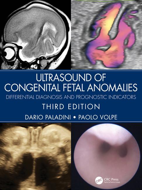 Книга Ultrasound of Congenital Fetal Anomalies Dario Paladini