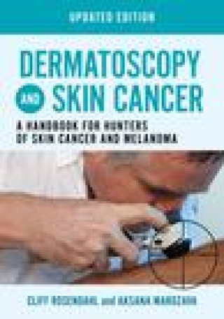 Книга Dermatoscopy and Skin Cancer, updated edition Cliff Rosendahl