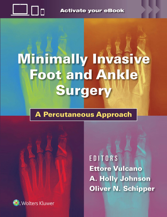 Könyv Minimally Invasive Foot and Ankle Surgery Vulcano