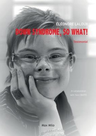 Knjiga Down Syndrome, So What! Yann Barte