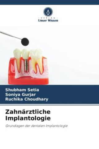 Carte Zahnärztliche Implantologie Soniya Gurjar