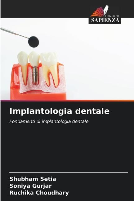 Kniha Implantologia dentale Soniya Gurjar