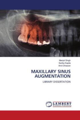 Knjiga MAXILLARY SINUS AUGMENTATION Sarika Kapila
