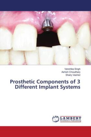Könyv Prosthetic Components of 3 Different Implant Systems Ashish Choudhary