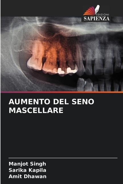 Knjiga AUMENTO DEL SENO MASCELLARE Sarika Kapila