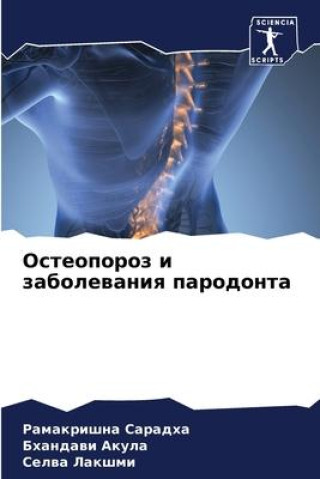 Knjiga Osteoporoz i zabolewaniq parodonta Bhandawi Akula