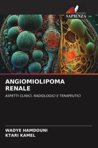 Book ANGIOMIOLIPOMA RENALE Ktari Kamel