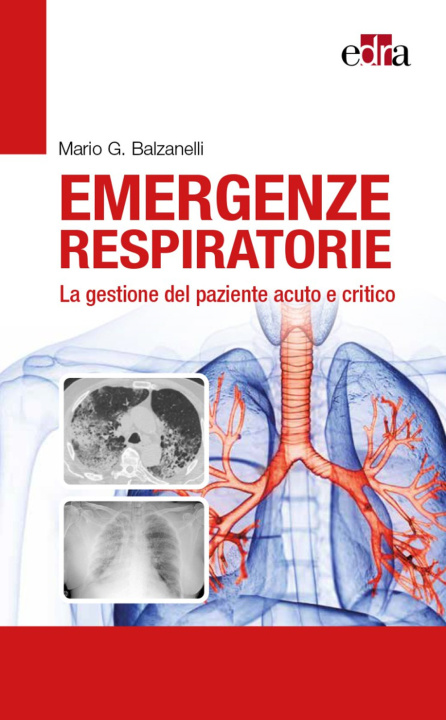 Книга Emergenze respiratorie. La gestione del paziente acuto e critico Mario Giosuè Balzanelli