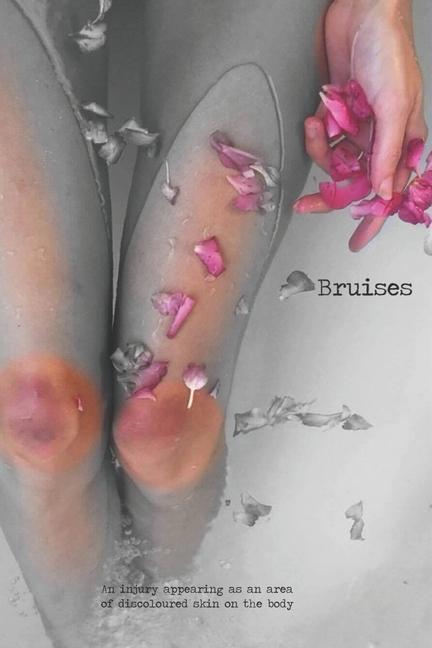Book Bruises Adam Shove